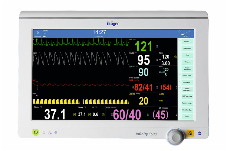 Infinity bedside patient monitor example